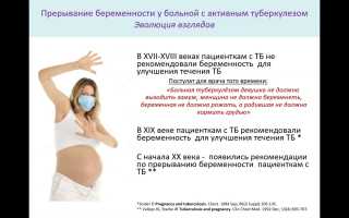 Туберкулез при беременности: важные аспекты и рекомендации