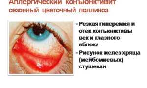 Капли глазные противоаллергические – против аллергии и воспаления в глазах для здоровья