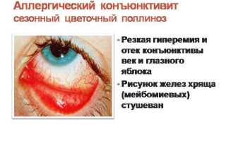 Капли глазные противоаллергические – против аллергии и воспаления в глазах для здоровья