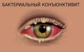 Капли от конъюнктивита для детей: противовирусные и глазные с антибиотиком для эффективного лечения