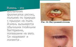 Как появляется ячмень на глазу – откуда берется и как проходит, причины и лечение