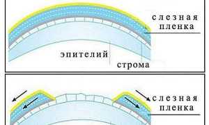 Чем снять покраснение с глаза – как убрать и избавиться от красноты быстро и эффективно