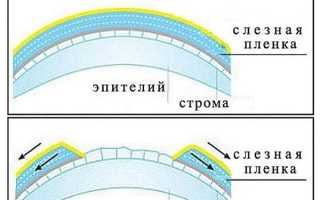 Чем снять покраснение с глаза – как убрать и избавиться от красноты быстро и эффективно