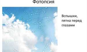 Отслоение сетчатки глаза: лечение народными средствами и профилактика