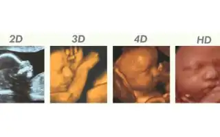 4D сонография во время беременности: преимущества и особенности