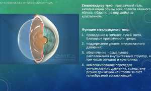 Что такое стекловидное тело глаза и плавающие помутнения в нем: причины и последствия
