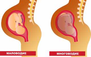 Маловодие при беременности: причины и последствия