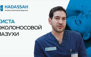 Киста гайморовой пазухи: способы лечения, советы врачей, видео
