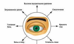 Признаки глаукомы: как вовремя определить и предотвратить?