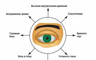 Признаки глаукомы: как вовремя определить и предотвратить?