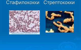 Гноится глаз у ребенка – что делать и чем лечить гной в домашних условиях