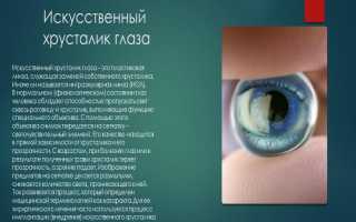 Хрусталик глаза – операция по замене на искусственным по научному подходу