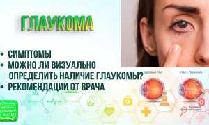 Глаукома лечится или нет – можно ли вылечить, исчезнет ли навсегда, и что об этом знать