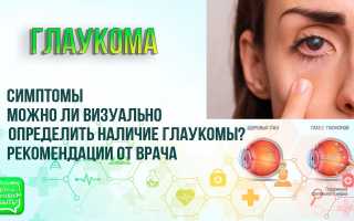 Глаукома лечится или нет – можно ли вылечить, исчезнет ли навсегда, и что об этом знать