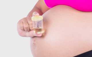 Почему важен общий анализ мочи при беременности для здоровья