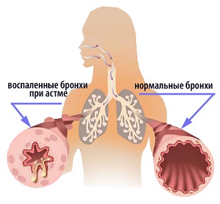 Бронхи