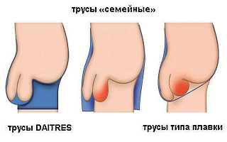 Причины болезни