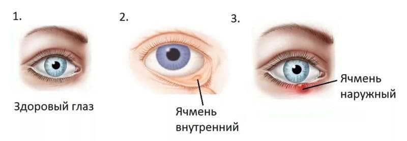 _