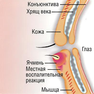 _