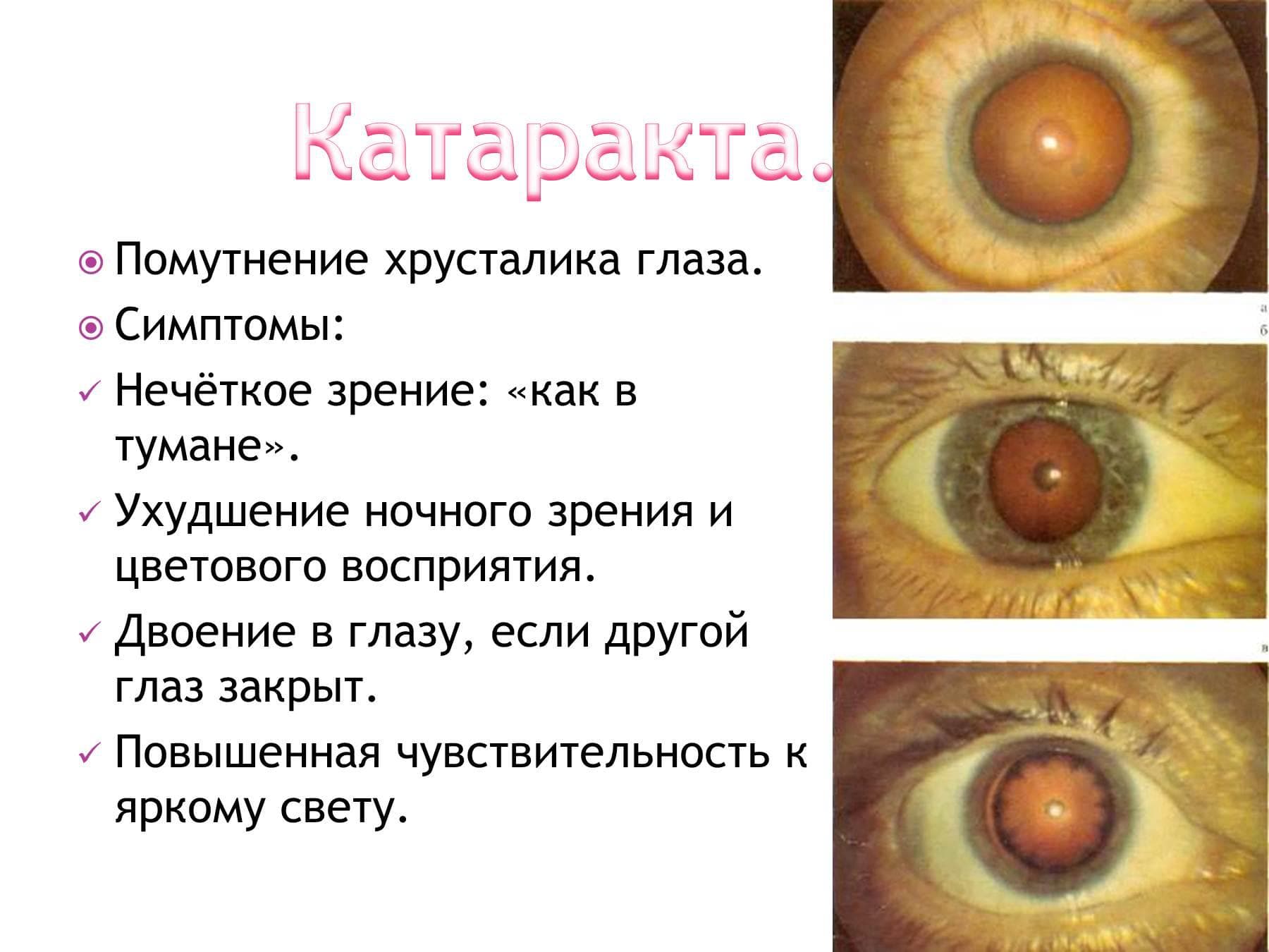 _