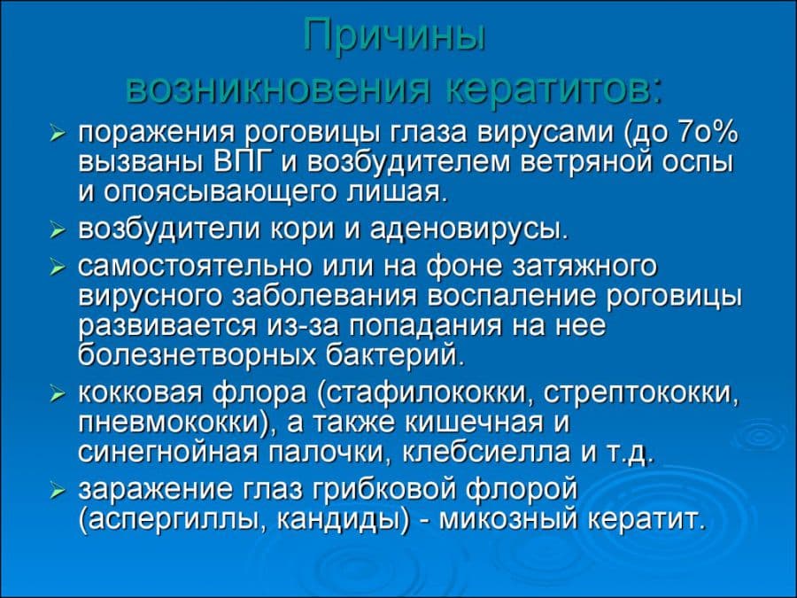 Причины кератитов