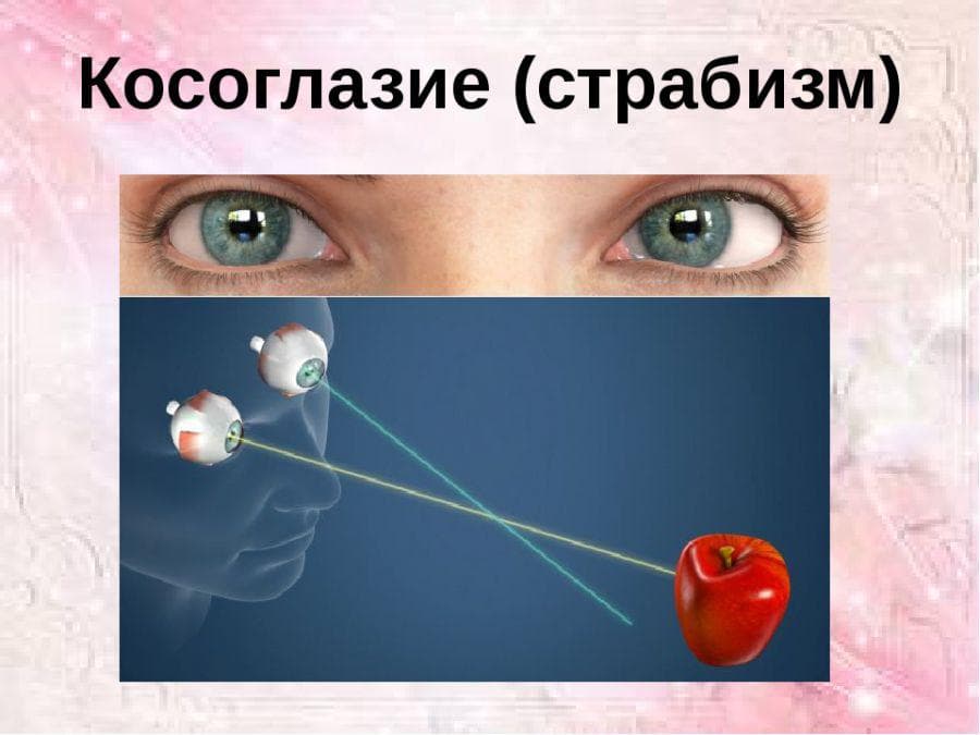 _