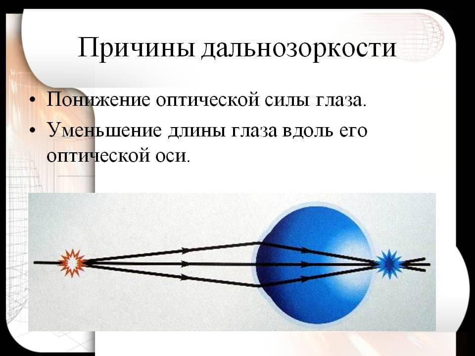 _