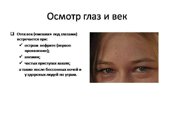 _
