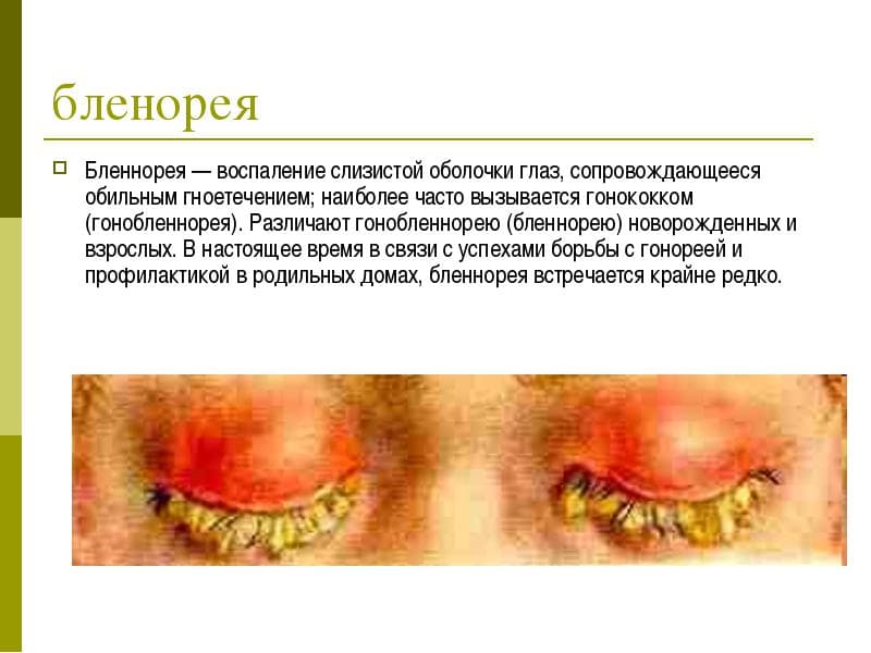 blenoreya