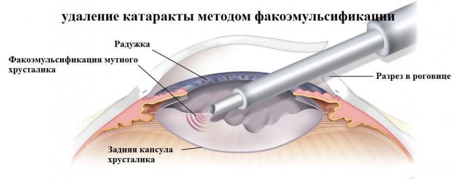 _