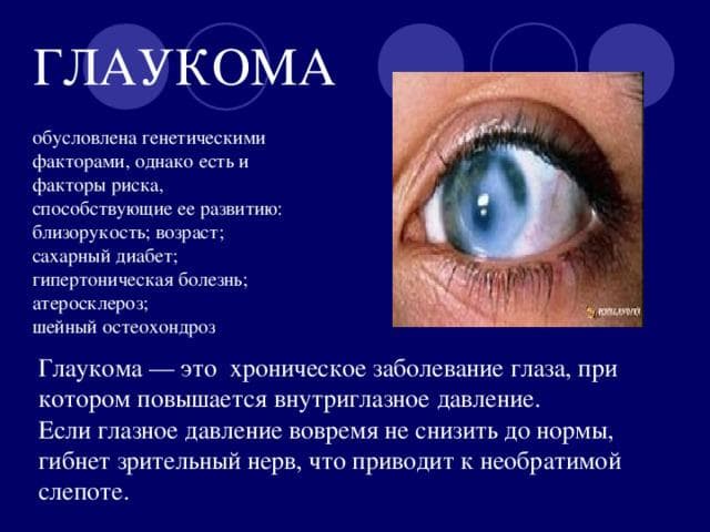 glaukoma
