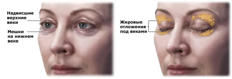 gryzha-vek
