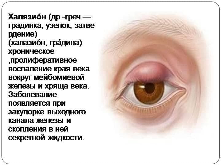 xalyazion