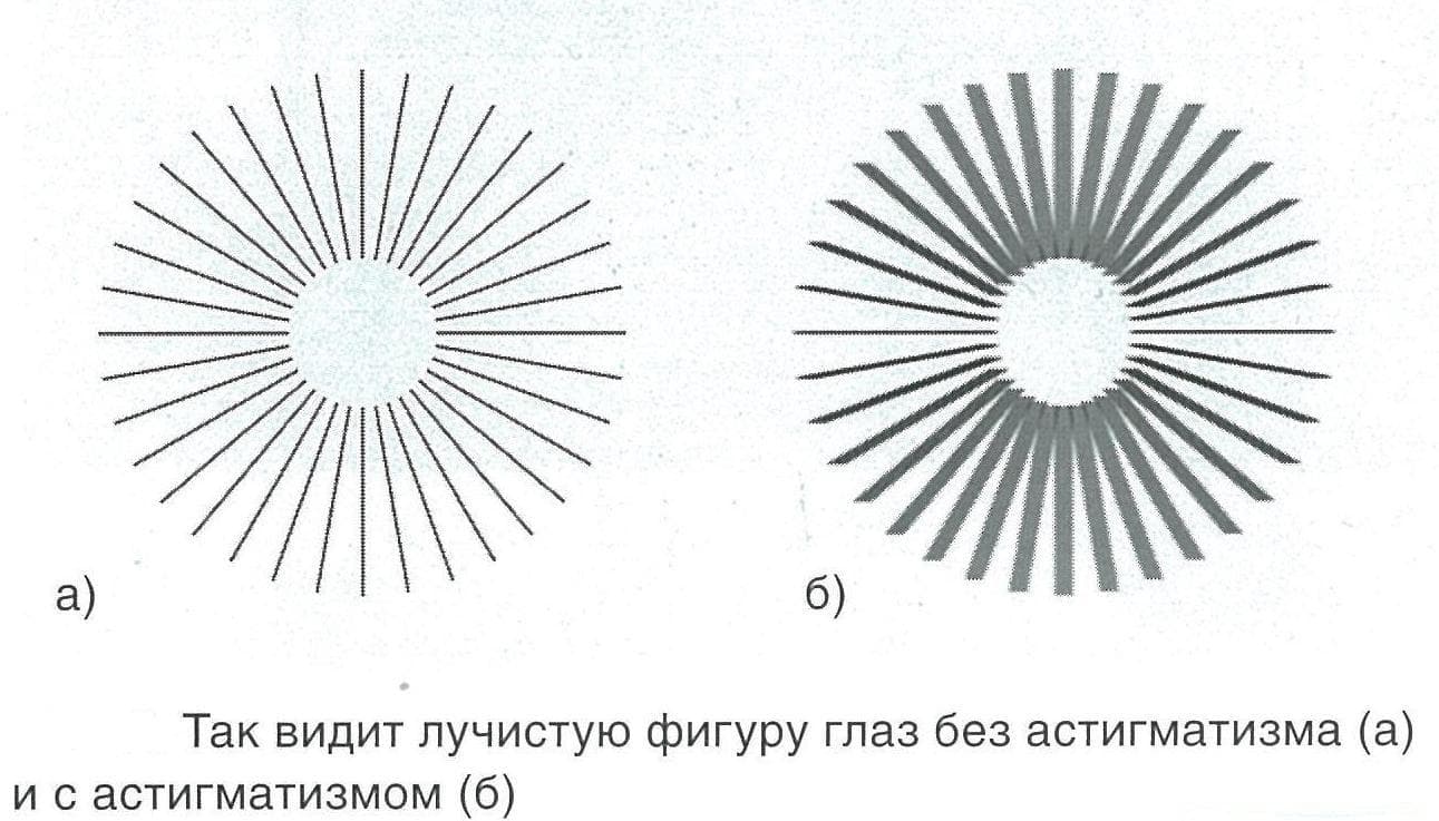 Как видит человек с астигматизмом