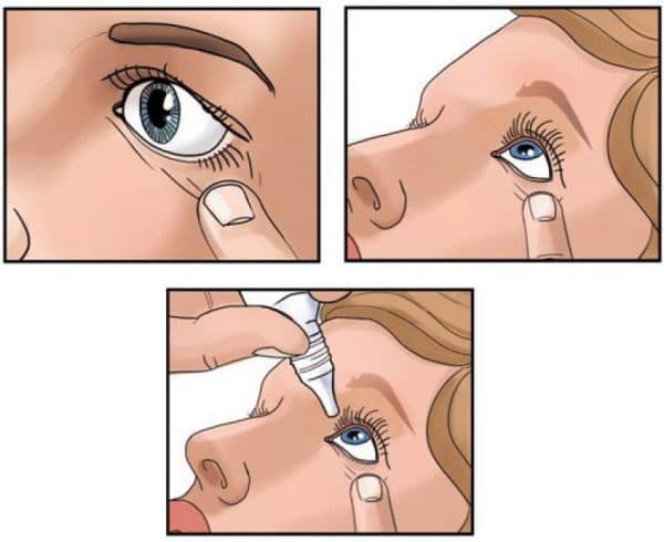 _