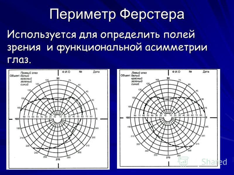 Кинетическая периметрия