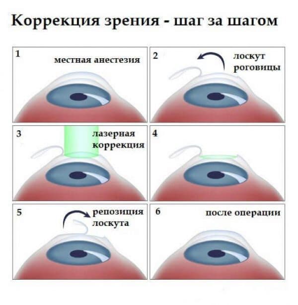 _