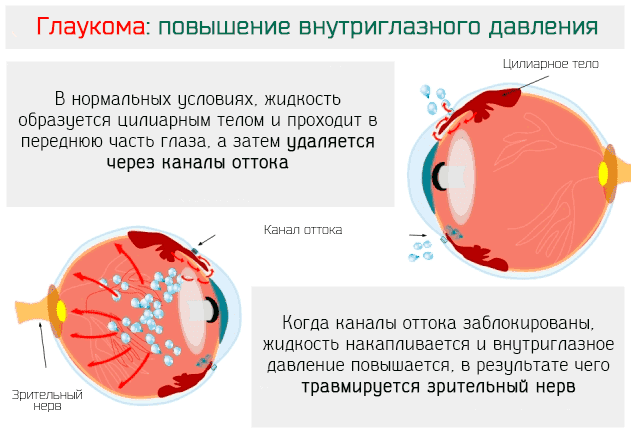 Норма глазного давления