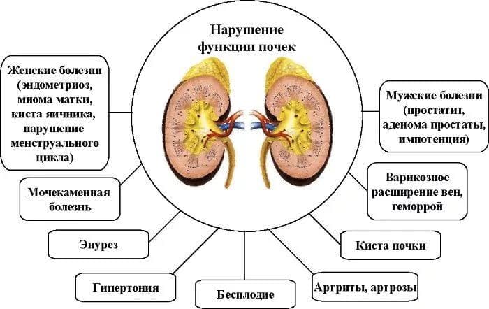 Патологии почек