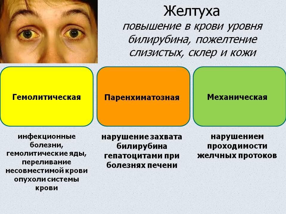 Пожелтение кожи в результате заболевания печени
