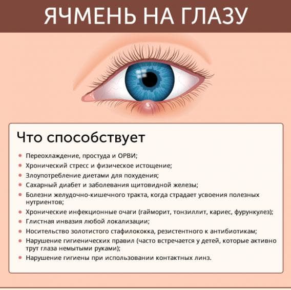 prichiny-vozniknoveniya-yachmenya