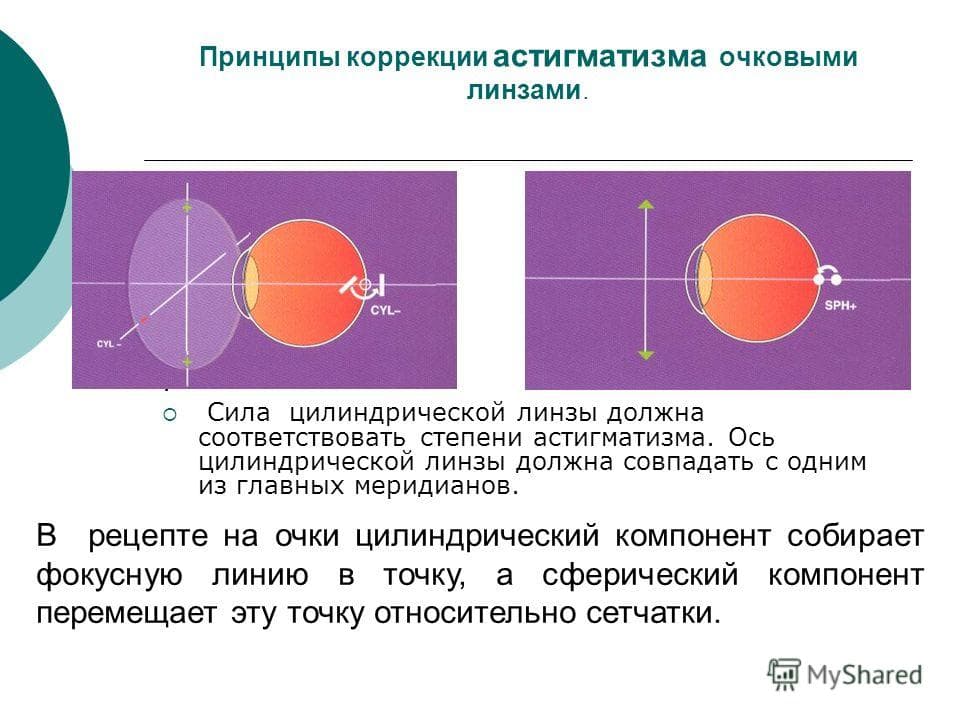 principy-lecheniya-astigmatizma-ochkami