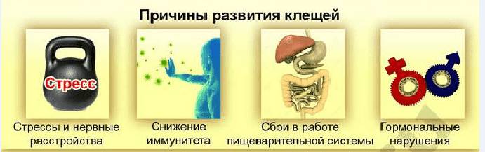 Причины демодекоза
