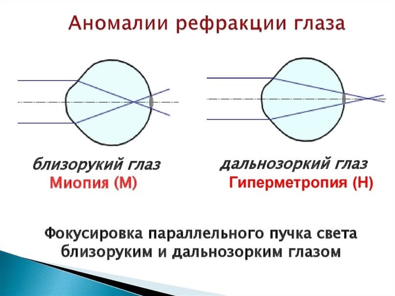_