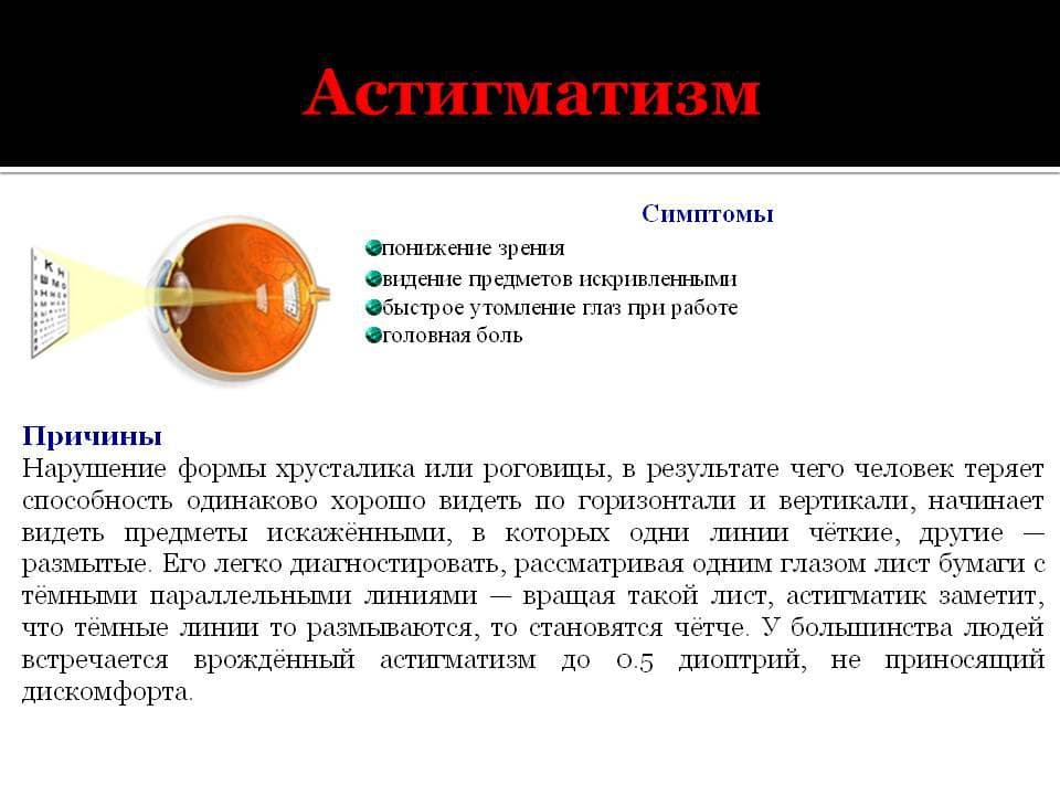simptomy-astigmatizma