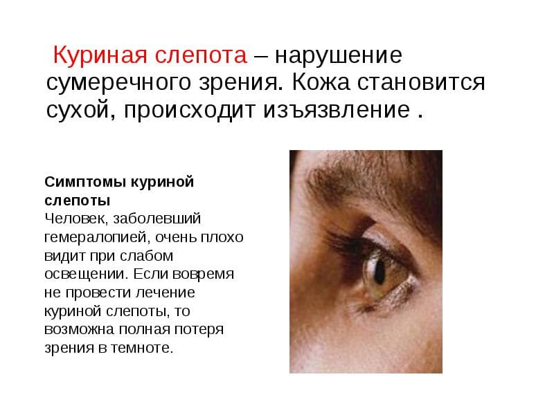 simptomy-kurinoj-slepoty