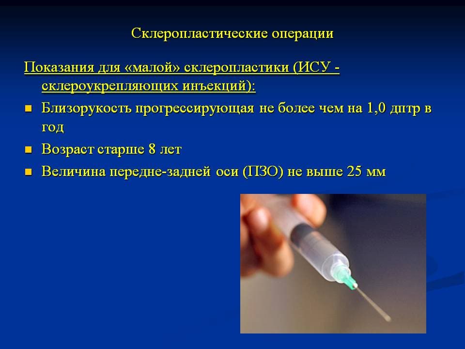 Склеропластика