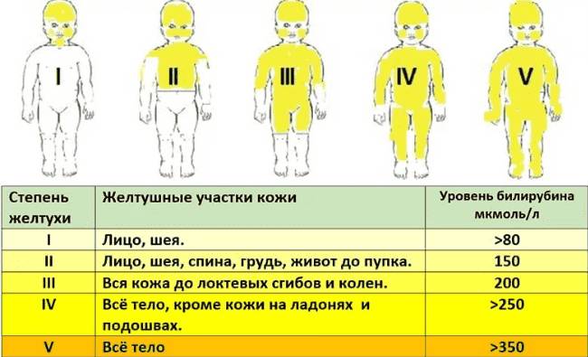 stepeni-patologii-pecheni-u-novorozhdennyx