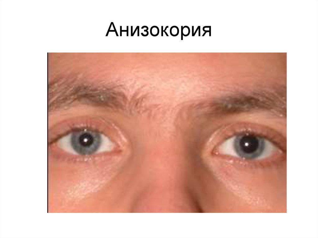 _