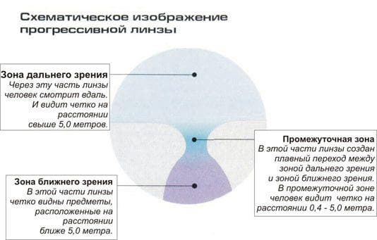 Перифокальные линзы: бифокальные, мультифокальные, для очков, разметка